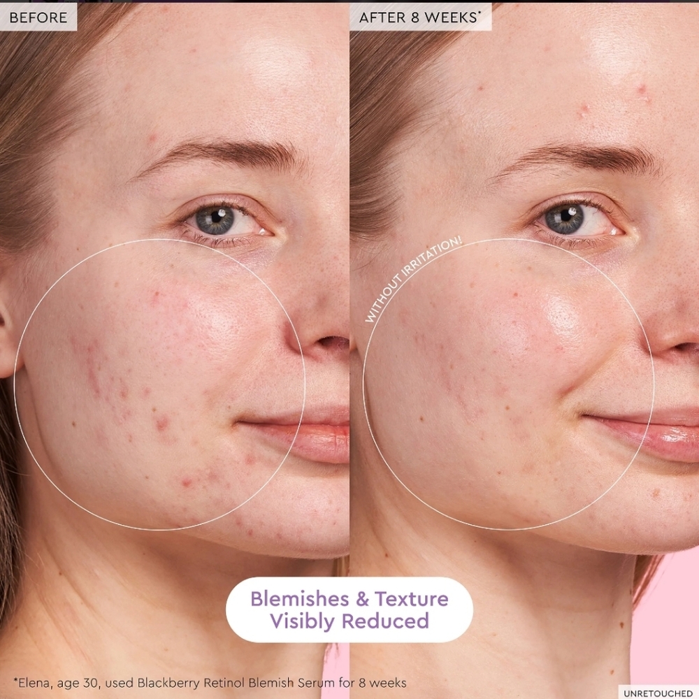 Glow Recipe Blackberry Retinol Blemish Serum + Skin Reset, 1oz, NIB - Picture 3 of 9